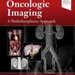 Oncologic Imaging: A Multidisciplinary Approach Volume 1-2 (Color)