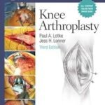 Master Techniques in Orthopaedic Surgery, Knee Arthroplasty(Color)