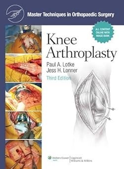 Master Techniques in Orthopaedic Surgery, Knee Arthroplasty(Color)