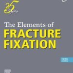 The Elements of Fracture Fixation (Color)