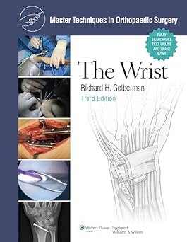 Master Techniques in Orthopaedic Surgery: The Wrist (Color)