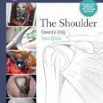 The Master Techniques in Orthopaedic Surgery: The Shoulder (Color)