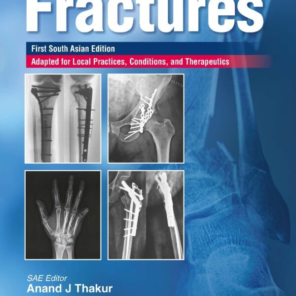 Handbook of fractures Volume 1-2 (Color)