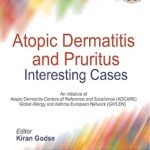 Atopic Dermatitis and Pruritus Interesting Cases (Color)