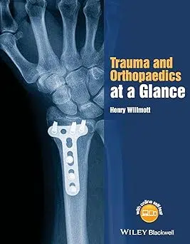71gmKAxsQpL._SY342_ Trauma and Orthopaedics at a Glance (Color) - Image 1
