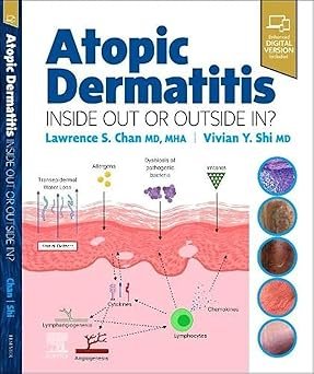 Atopic Dermatitis: Inside Out or Outside In (Color)