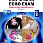 How to Do An Echo Exam (Color)
