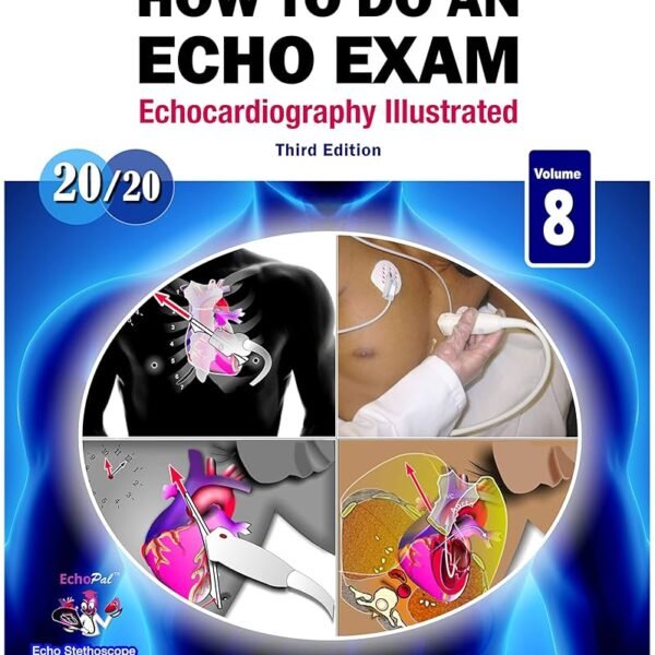 How to Do An Echo Exam (Color)