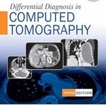 Differential Diagnosis in Computed Tomography (Color)