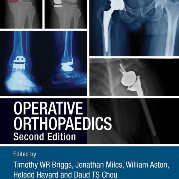 Operative Orthopaedics (Color)