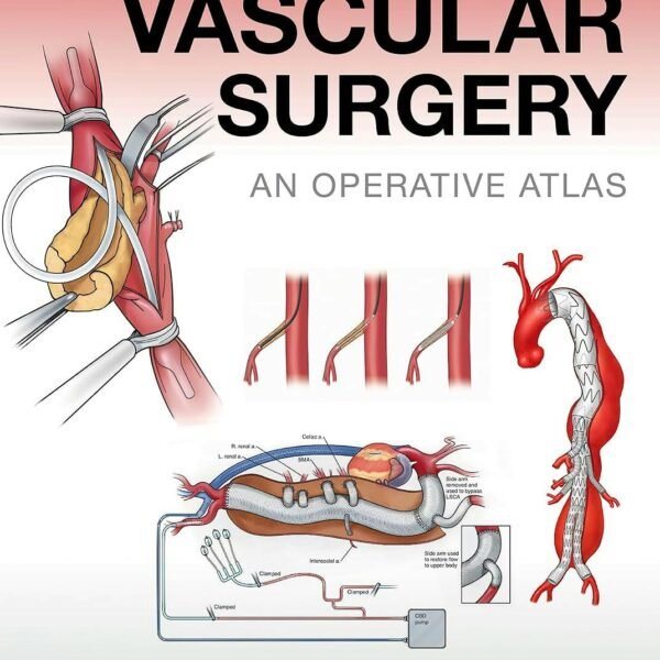 Gateways in Vascular Surgery: An Operative Atlas (Color)