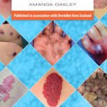Dermatology Made Easy (Color)