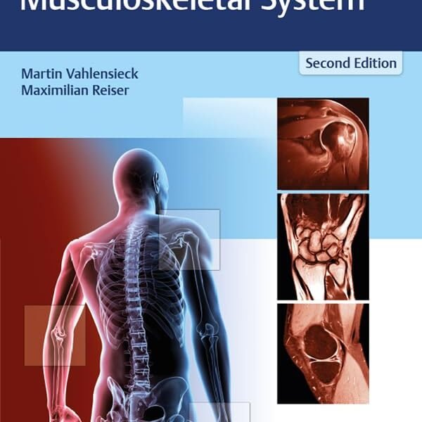 MRI of the Musculoskeletal System (Color)