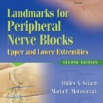 Landmarks for Peripheral Nerve Blocks: Upper and Lower Extremities (Color)