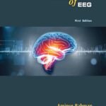 Basics of EEG
