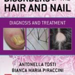 Disorders of the Hair and Nail Diagnosis and Treatment (Color)