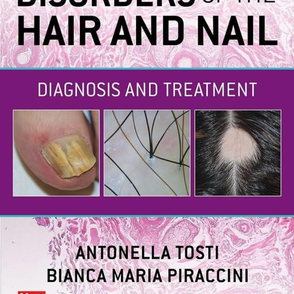 Disorders of the Hair and Nail Diagnosis and Treatment (Color)