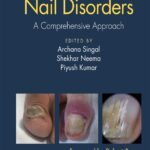 Nail Disorders: A Comprehensive Approach (Color)