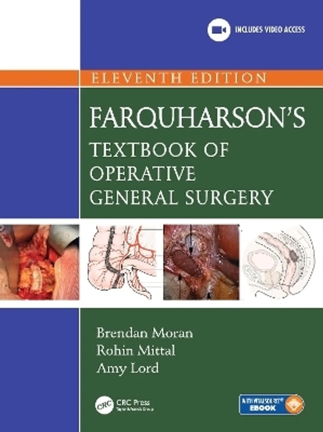 farquharson-s-textbook-of-operative-general-surgery-original-imahgkpmvf2y5dre