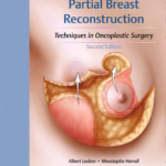 Partial Breast Reconstruction : Techniques in Oncoplastic Surgery (Color)
