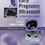 Early Pregnancy Ultrasound A Practical Guide (Color)