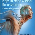 Local and Regional Flaps in Head and Neck Reconstruction: A Practical Approach (Color)