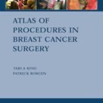 Atlas of Procedures in Breast Cancer Surgery (Color)