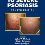 Mild to Moderate and Moderate to Severe Psoriasis (Color)