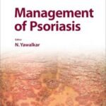 Management of Psoriasis (Color)