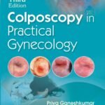 Colposcopy in Practical Gynecology (Color)