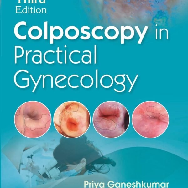 Colposcopy in Practical Gynecology (Color)