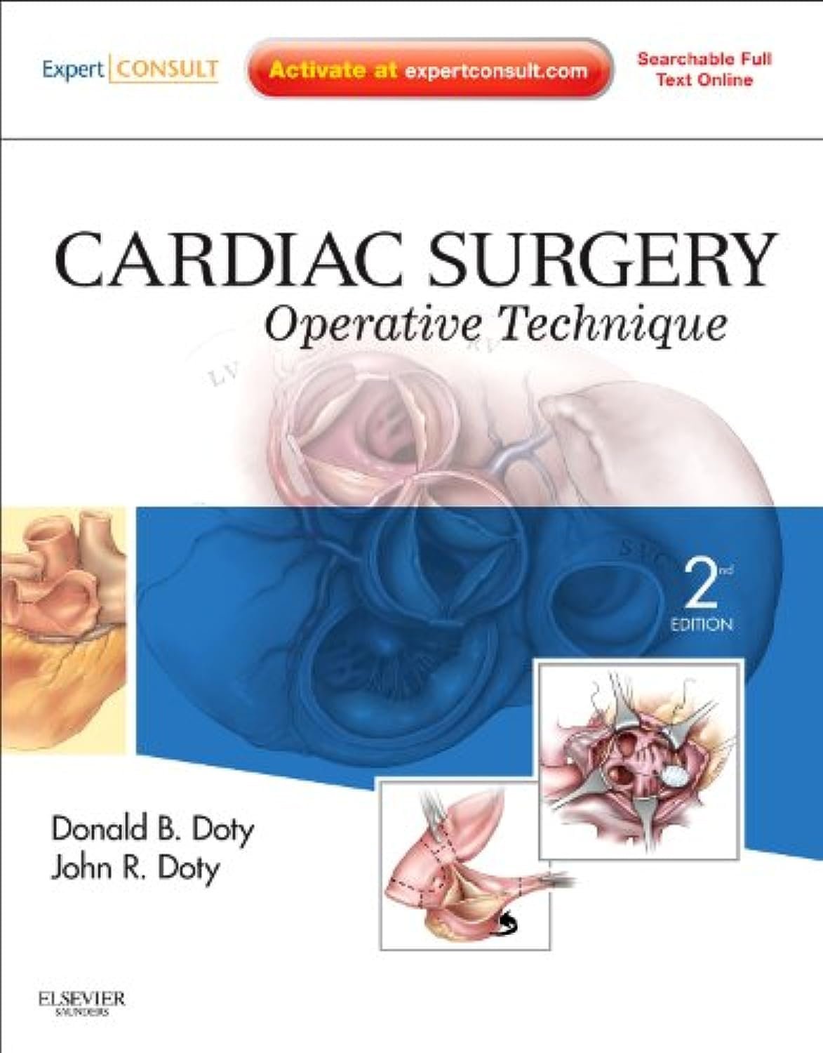 61a7swSLWIL Cardiac Surgery: Operative Technique (Color) - Image 1