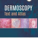 Dermoscopy Text and Atlas (Color)