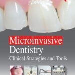 Microinvasive Dentistry Clinical Strategies and Tools (Color)