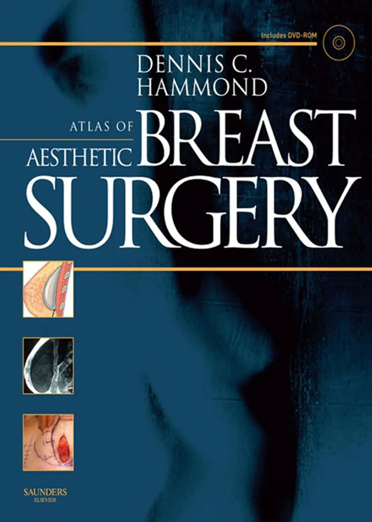 atlas-of-aesthetic-breast-surgery