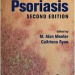 Psoriasis (Color)