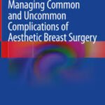 Managing Common and Uncommon Complications of Aesthetic Breast Surgery (Color)