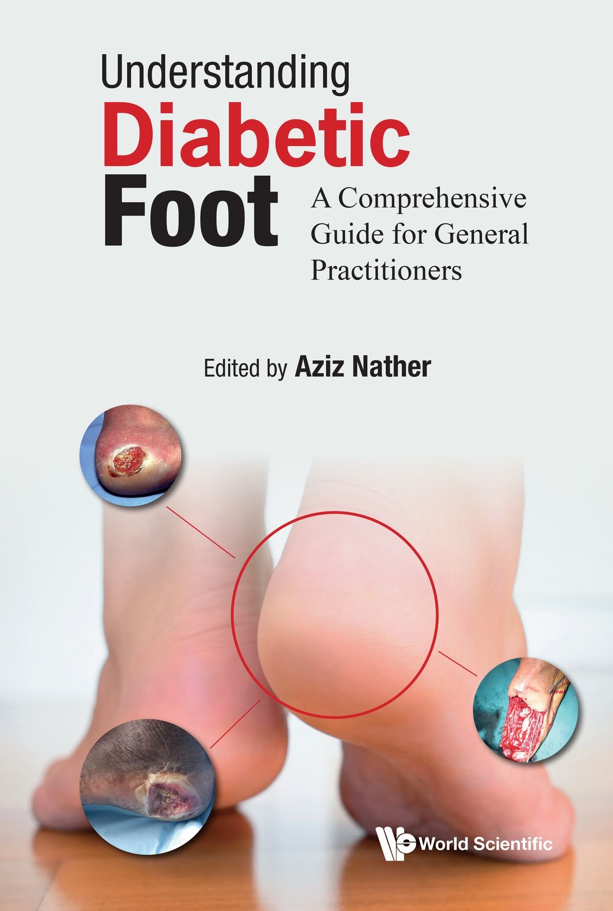 understanding-diabetic-foot Understanding Diabetic Foot: A Comprehensive Guide For General Practitioners (Color) - Image 1