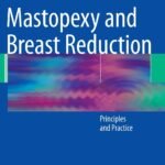 Mastopexy and Breast Reduction: Principles and Practice (Color)