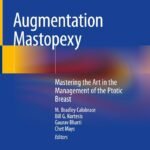 Augmentation Mastopexy: Mastering the Art in the Management of the Ptotic Breast (Color)