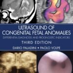 Ultrasound of Congenital Fetal Anomalies: Differential Diagnosis and Prognostic Indicators (Color)