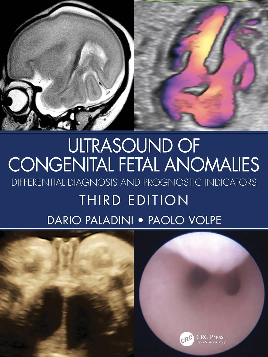 71IgUrsMNoL._SL1500_ Ultrasound of Congenital Fetal Anomalies: Differential Diagnosis and Prognostic Indicators (Color) - Image 1