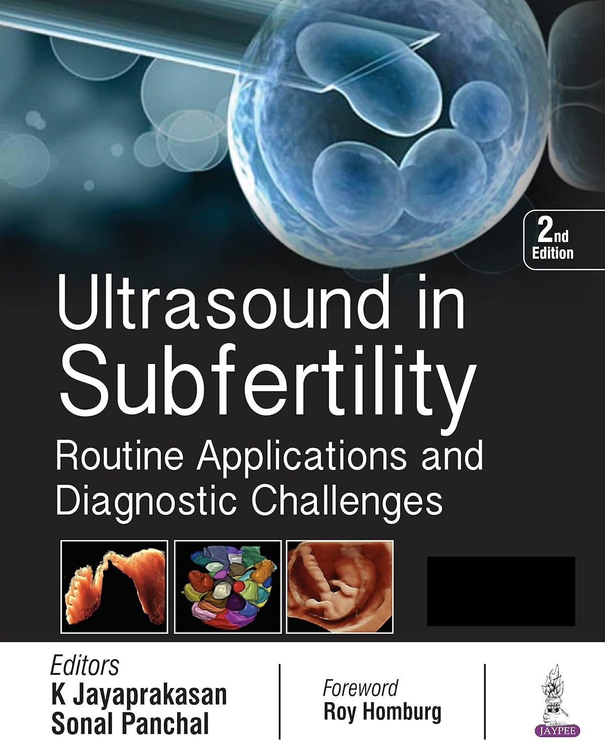 81qrWaxYCLS._SL1500_ Ultrasound in Subfertility: Routine Applications and Diagnostic Challenges (Color) - Image 1