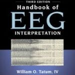 Handbook of EEG Interpretation (Color)