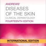 Andrews Diseases of the Skin Clinical Dermatology
