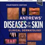 Andrews Diseases of the Skin Clinical Dermatology