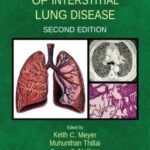Clinical Handbook of Interstitial Lung Disease (Color)