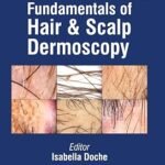 Fundamentals of Hair and Scalp Dermoscopy (Color)