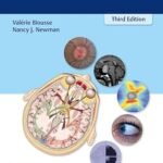 Neuro Ophthalmology Illustrated (Color)