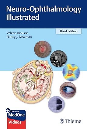 000000000000 Neuro Ophthalmology Illustrated (Color) - Image 1